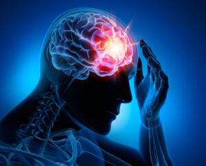 Why Hire Wisehart Wright Trial Lawyers After a Brain Injury in Cleveland, OH?